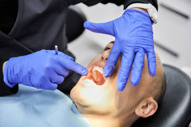 Best Emergency Dental Care for Broken or Chipped Teeth in Ceredo, WV